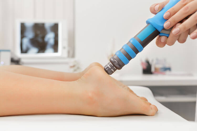 Extracorporeal Shock Wave Therapy