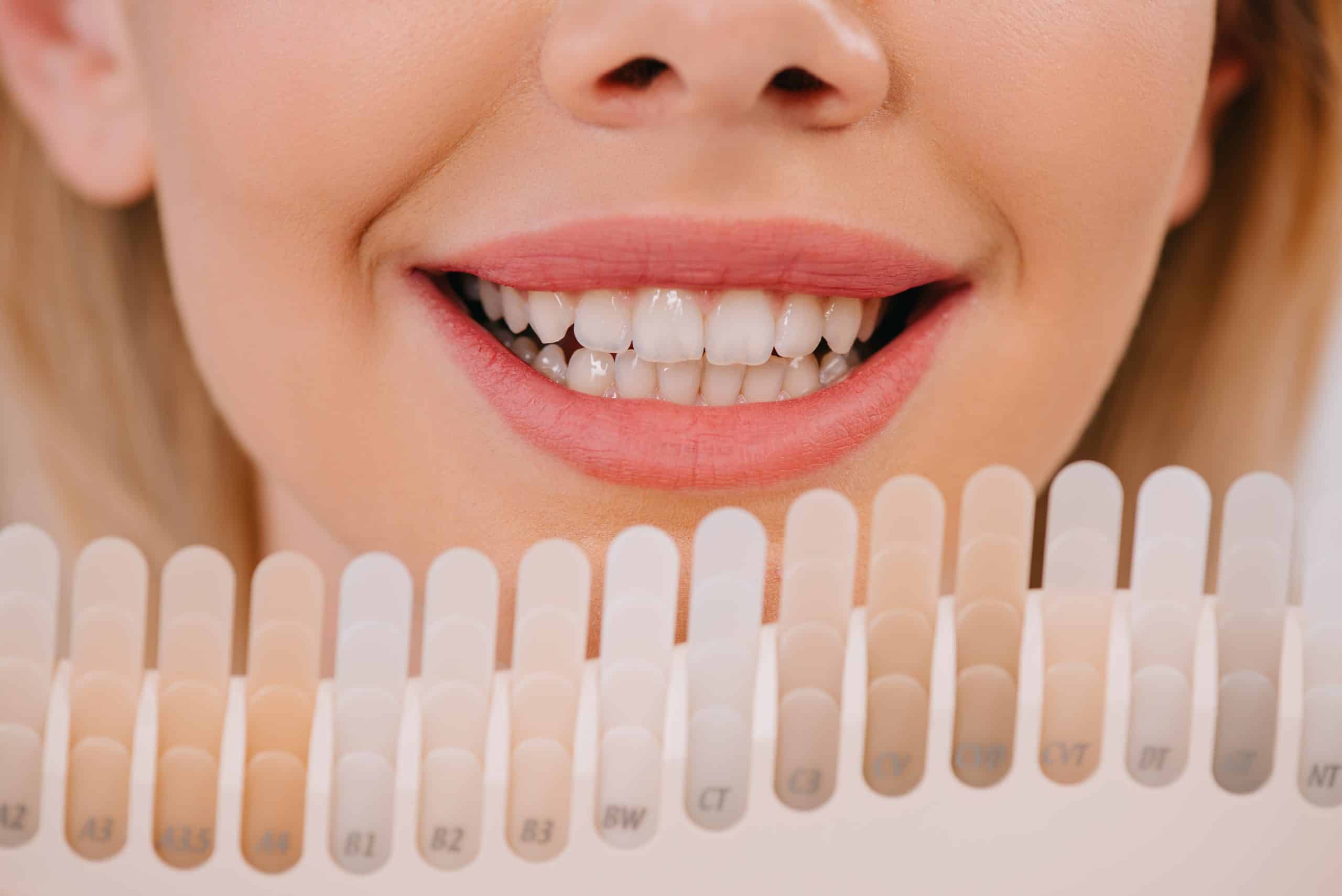 wisdom tooth extraction singapore