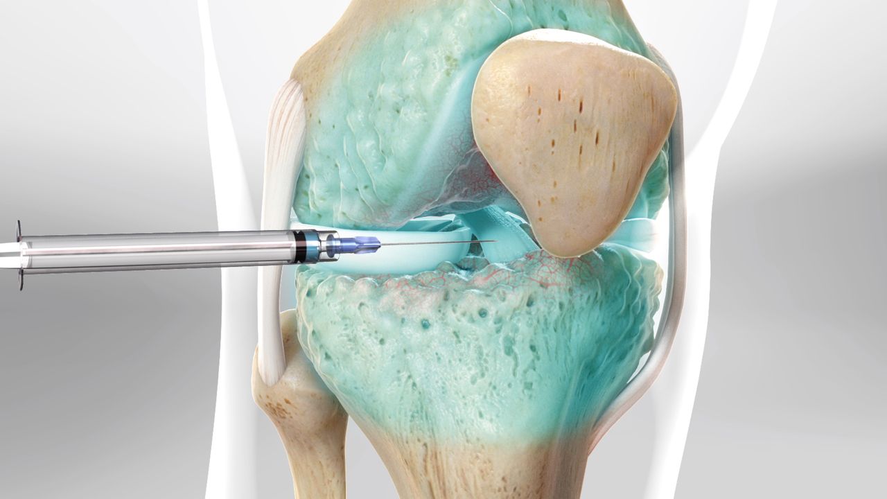 knee joint injection
