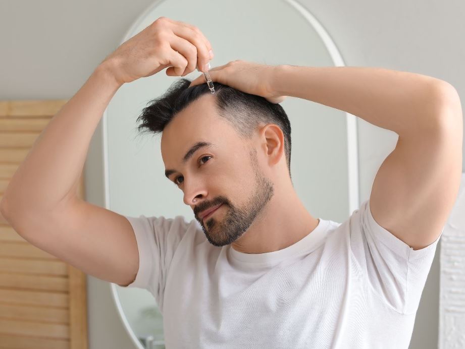does topical finasteride work