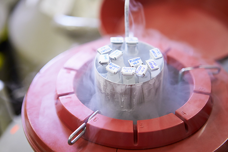 Best Fertility Preservation Options: About Freezing The Sperms